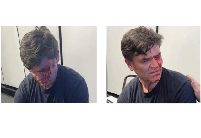 O assessor Eduardo Lima, no dia da agressão | Reprodução