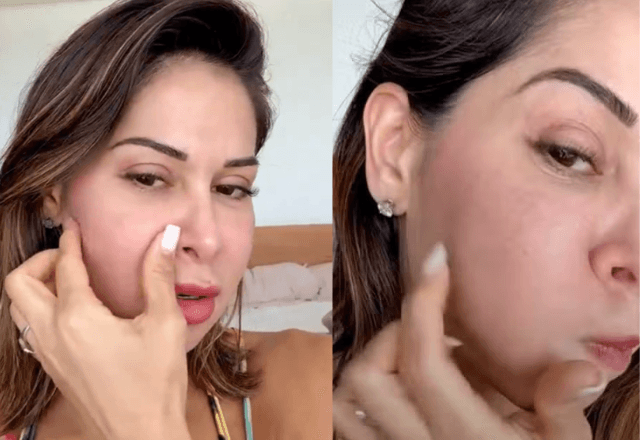 Maíra Cardi compartilha resultado de procedimento estético | Reprodução/Instagram
