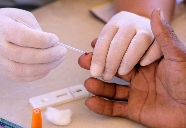 Mais de 40 testes de etapa única, ou seja, que não precisam ser processados numa fase posterior, poderão ser realizados nos locais | Arquivo Secom