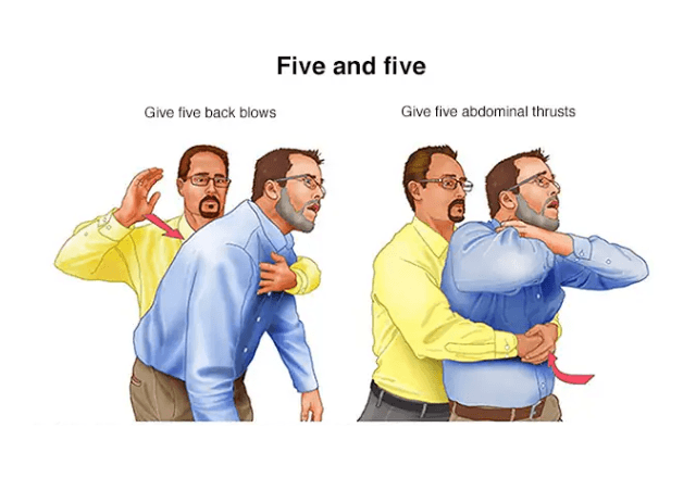 Manobras em crianças e adultos | Foto: reprodução/Mayo Foundation