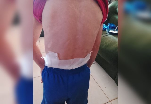 Menino foi levado pelo Conselho Tutelar para exame de corpo de delito no IML e depois para atendimento médico | Reprodução