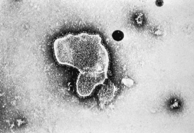Metapneumovírus (HPMV) é responsável por surto recente na China | CDC/EUA/ND