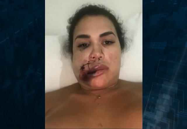 Caso de corretora agredida poderá ser julgado como tentativa de homicídio Caso de corretora agredida poderá ser julgado como tentativa de homicídio