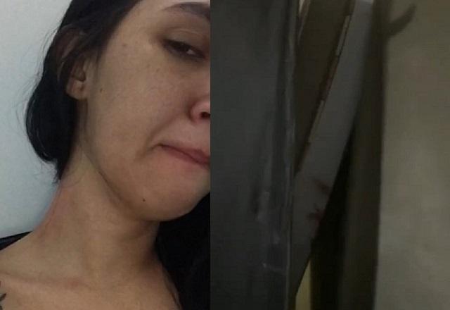 Montagem de fotos com mulher jovem mostrando pescoço com hematoma e, à direita, colchões empilhados em frente a porta