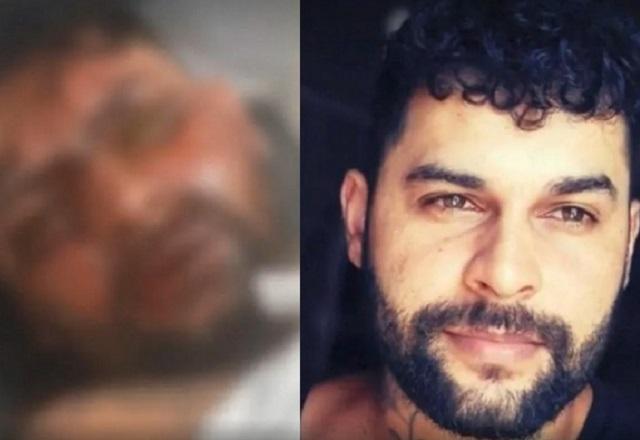 Montagem de fotos com rosto desfocado de homem completamente ferido e, à direita, rosto de homem branco de barba