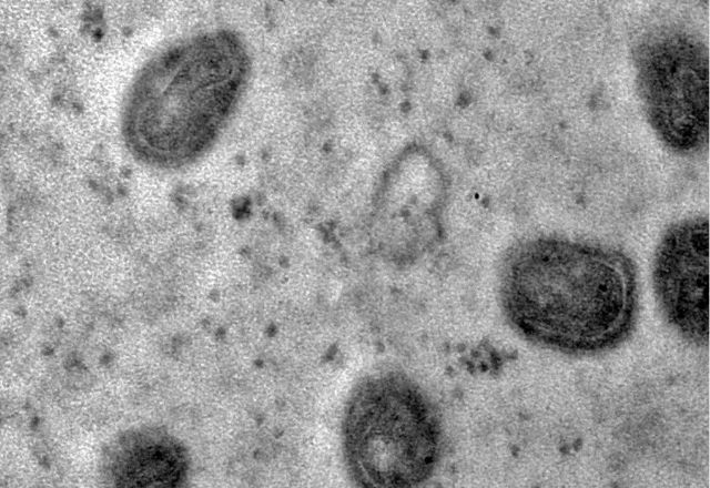 Mpox é uma doença zoonótica viral | Débora Barreto/Fiocruz