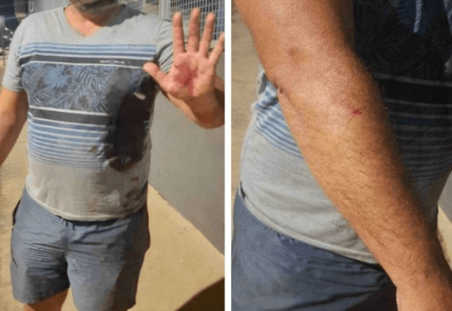 Vítima foi agredida no braço direito, na mão esquerda e no lado esquerdo do tórax | EM