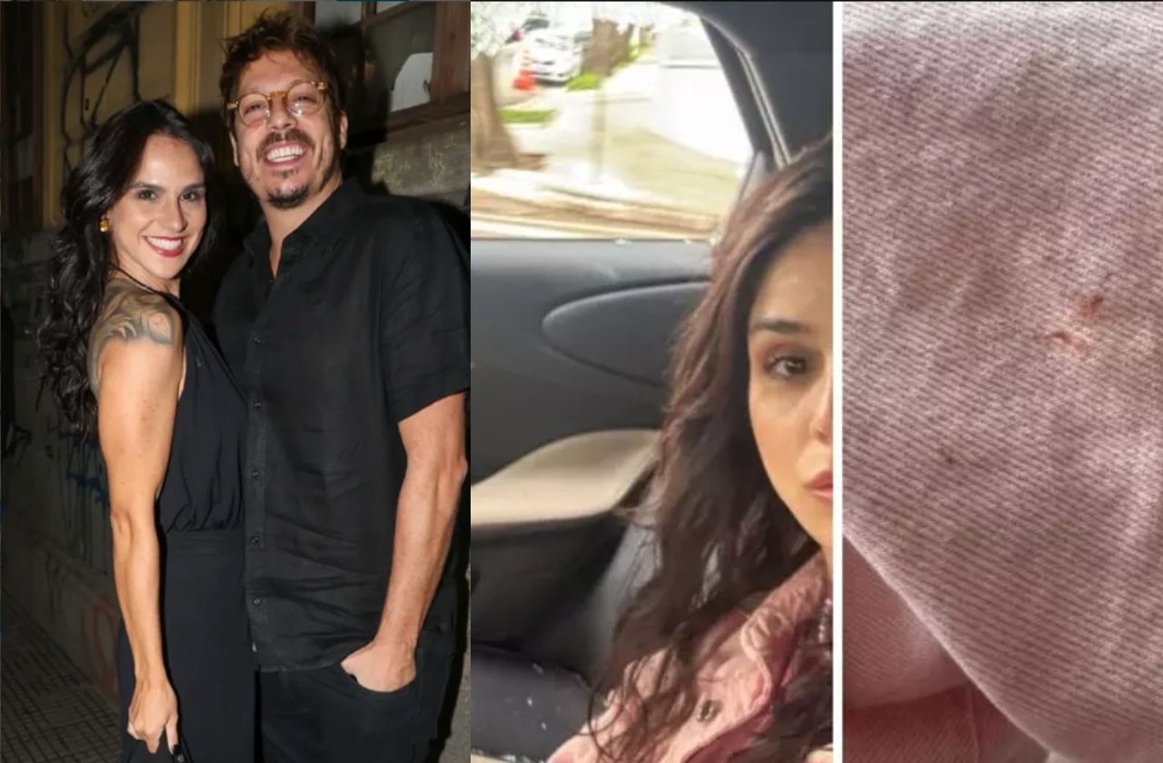 Priscila mostrou os ferimentos após a tentativa de assalto | Redes Sociais / Reprodução