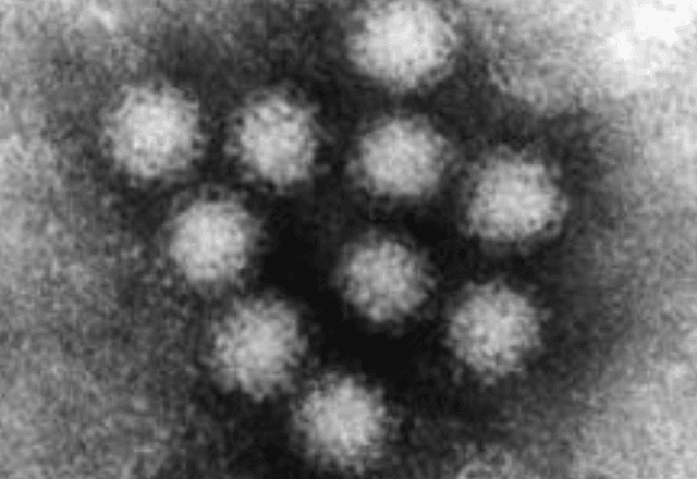 Norovírus foi detectado na Baixada Santista; veja sintomas e como se prevenir | Wiki 