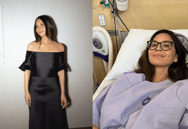 Atriz de 'X-Men' diz que tem tricotilomania; entenda distúrbio que faz pessoa arrancar o cabelo | Reprodução/Instagram