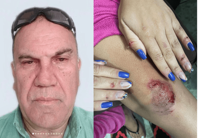 Passageira de 28 anos que sofreu tentativa de estupro por motorista de app diz que sentiu medo