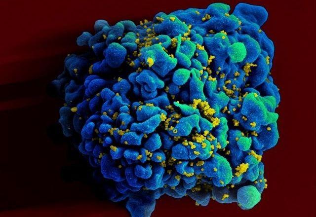 HIV: dois casos de cura do vírus são anunciados