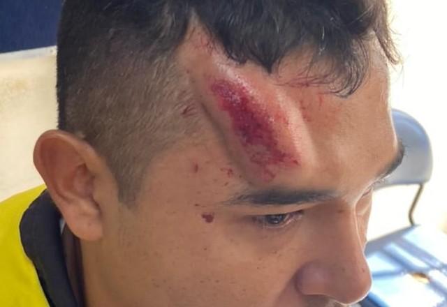 Policial com hematoma na testa