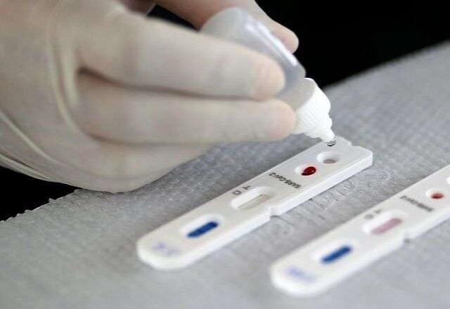 Covid-19: Brasil registra mais 1.023 casos e 66 mortes em 24 horas