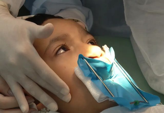 Qual é a importância da cirurgia na vida de pessoas com lábio leporino? | Divulgação/TV Brasil