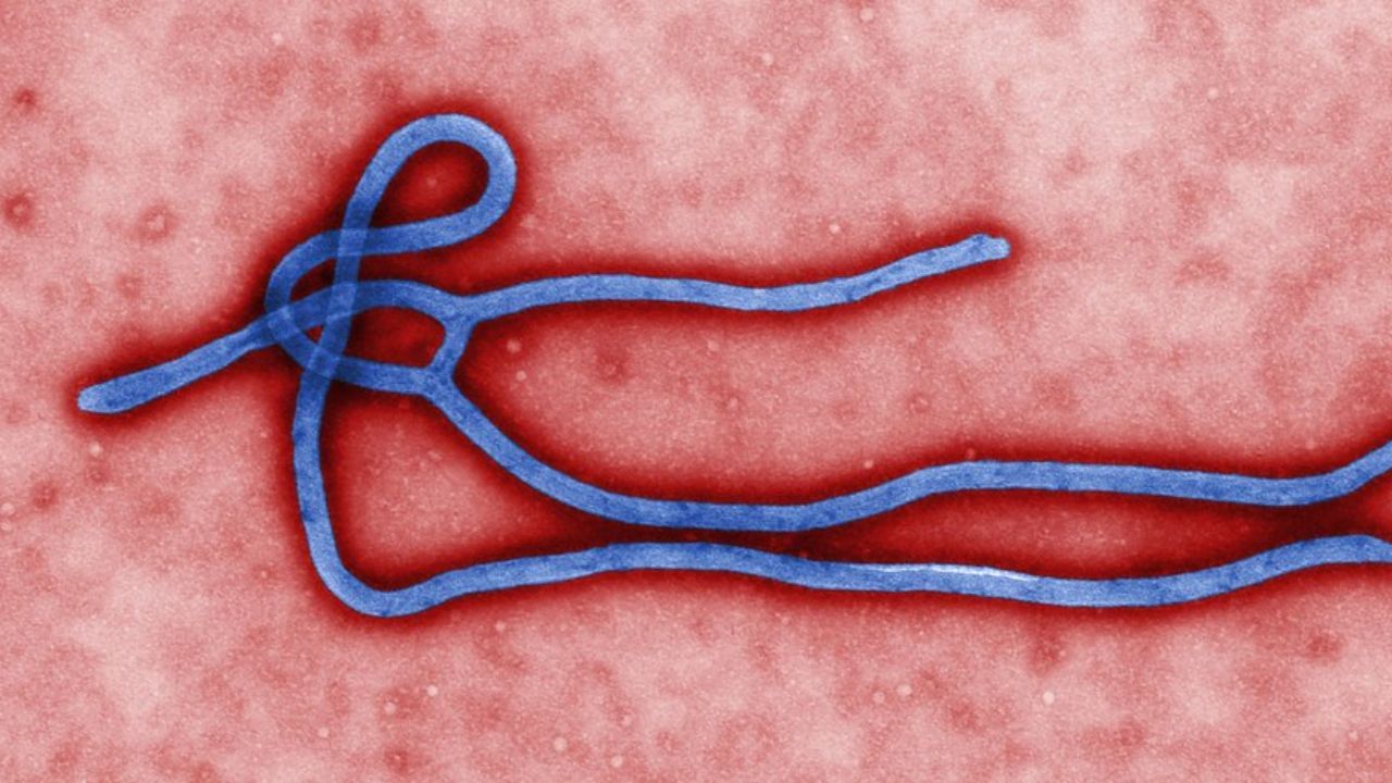 Ebola: o que se sabe sobre os dois casos suspeitos no Brasil Ebola: o que se sabe sobre os dois casos suspeitos no Brasil