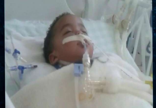 SP: bebê de 2 anos sofre paralisia cerebral após se engasgar com fruta SP: bebê de 2 anos sofre paralisia cerebral após se engasgar com fruta