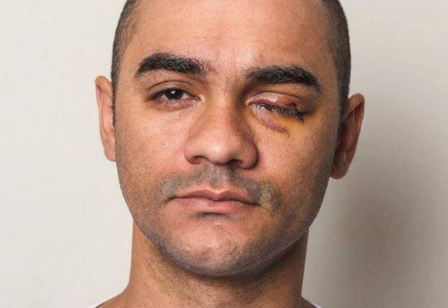 Sérgio Silva, fotógrafo que perdeu a visão de um olho ao ser atingido por uma bala de borracha disparada por um PM