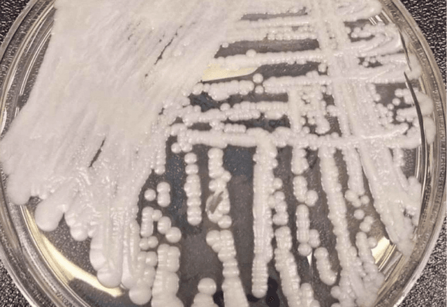 Superfungo é identificado em hospital de BH | CDC/Divulgação