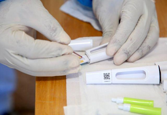 Teste rápido COVID-19 para o efetivo da Segurança Pública