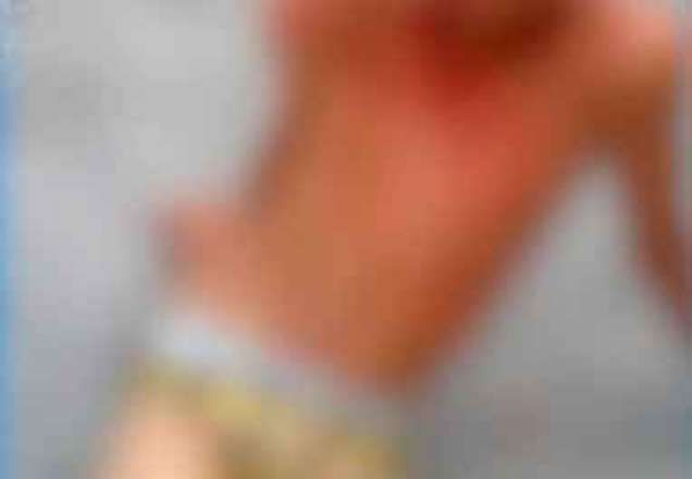 Torcedor é espancado antes de jogo e perde seis dentes Torcedor é espancado antes de jogo e perde seis dentes
