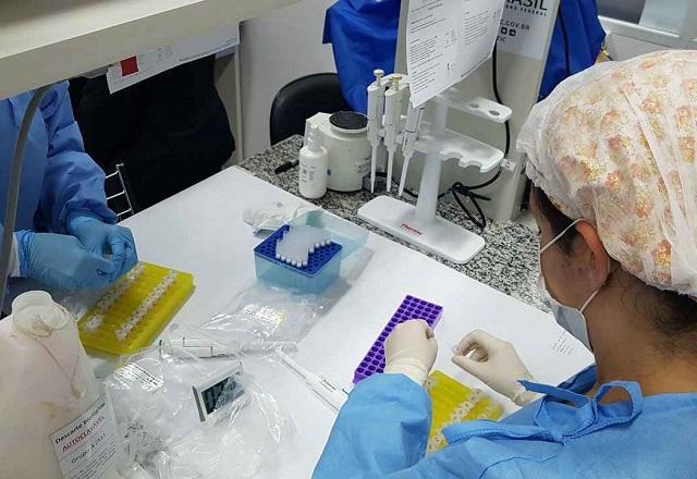 Pesquisadores da UFMG criam teste que detecta covid-19 pela urina Pesquisadores da UFMG criam teste que detecta covid-19 pela urina