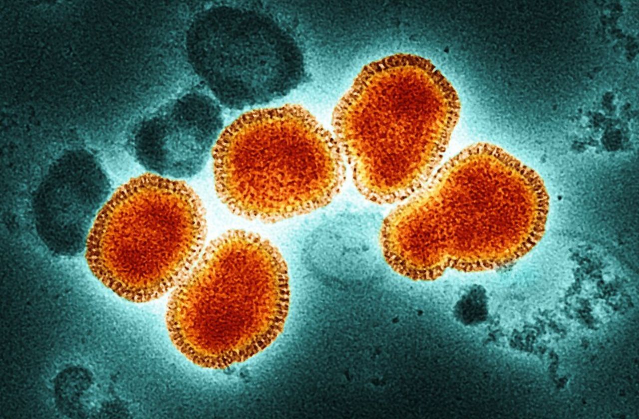 Vírus Influenza A (H3N2) | Wikimedia Commons / Reprodução