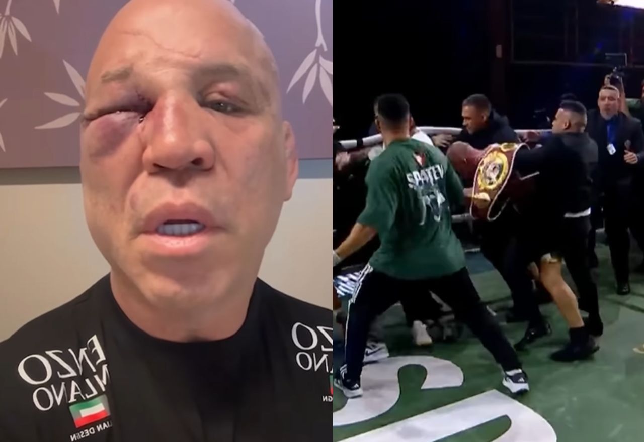 Wanderlei Silva: "Fui covardemente agredido" | Reprodução/Redes sociais