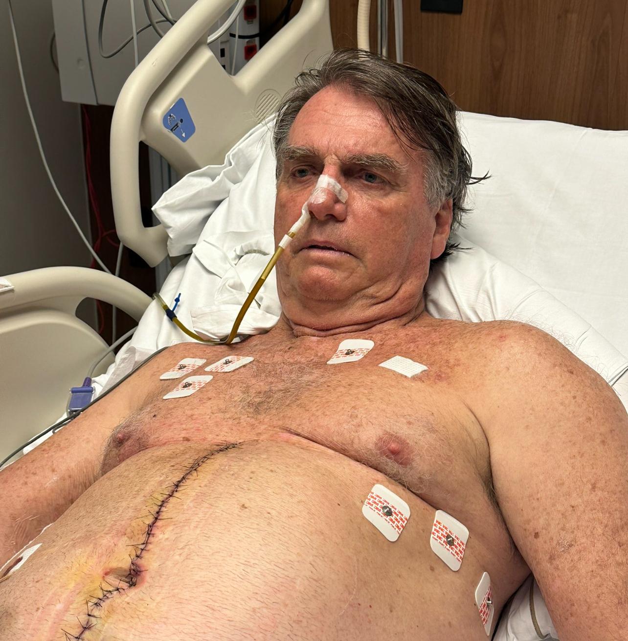 Na UTI, Bolsonaro publica foto sem camisa e com cicatriz da cirurgia | Foto: reprodução X