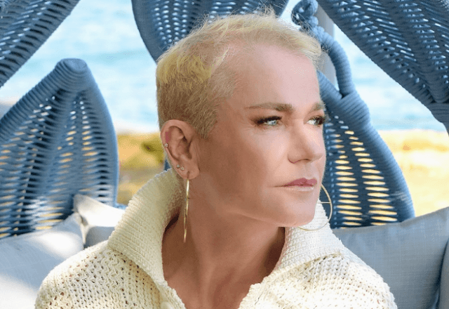 Xuxa foi diagnosticada com alopecia androgenética | Blad Meneghel/Instagram/Reprodução