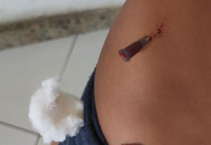 Família denuncia que agulha foi esquecida no corpo de criança