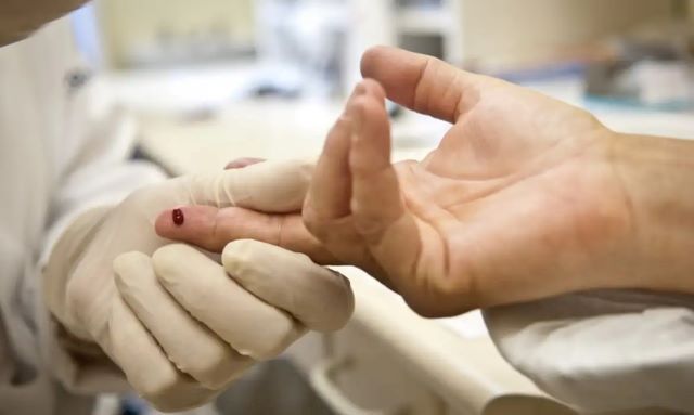 Uma pessoa morre por minuto no mundo por complicações da aids, diz ONU