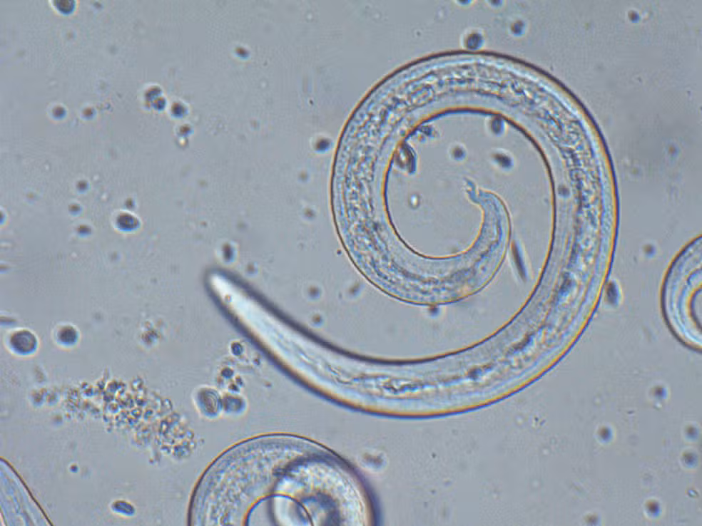 Imagem do angiostrongylus cantonensis | Stefan Walkowski/Divulgação