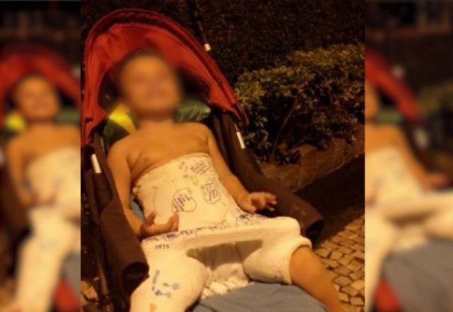 criança com gesso em carrinho de bebê, após agressão