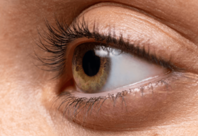 Deficiência visual poderia ser evitada na maior parte dos casos | Freepik