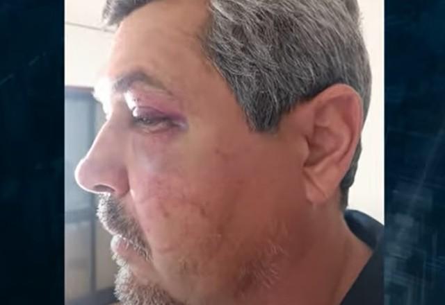 engenheiro agredido