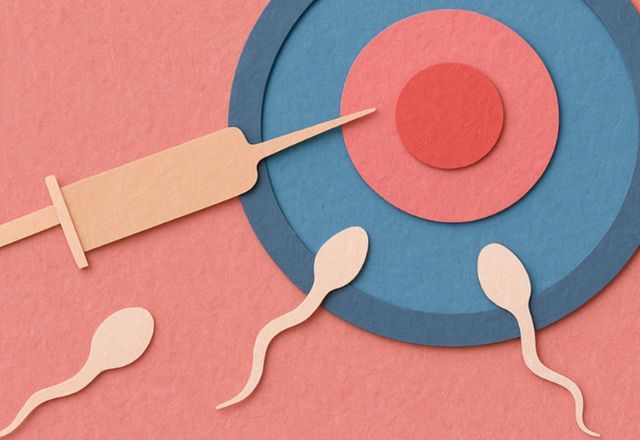 Ilustração do processo de fertilização in vitro realizado por IA | Reprodução