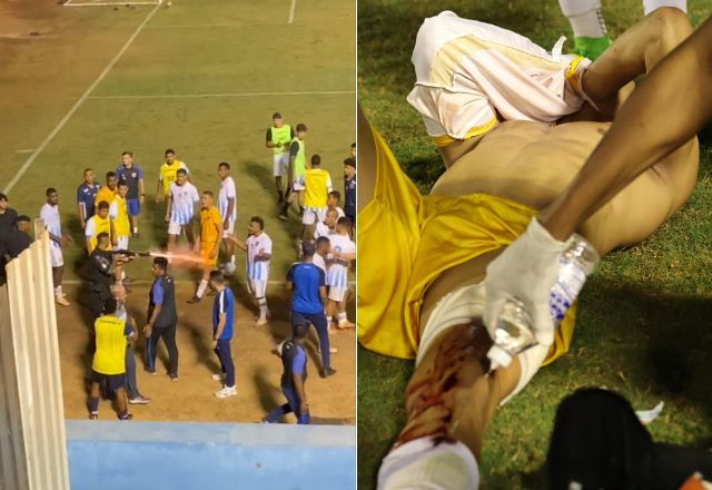 Goleiro do Grêmio Anápolis leva tiro de bala de borracha de PM após jogo; veja vídeo Goleiro do Grêmio Anápolis leva tiro de bala de borracha de PM após jogo; veja vídeo
