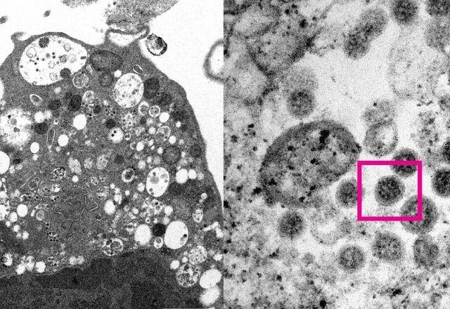 imagem da variante ômicron do coronavirus registrado por um microscópio