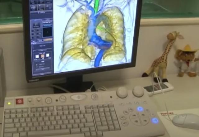 imagem de um corpo de criança em um computador médico