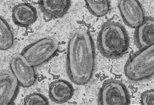 imagem mostra Bruno Lopes, que morreu de monkeypox.