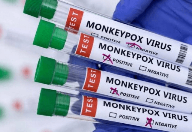 Testes de Mpox  | Foto: Divulgação 