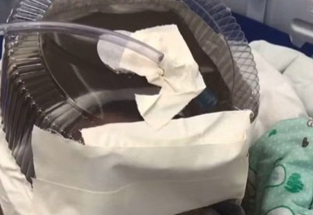 Embalagem de bolo como máscara em bebê: pai fala sobre o caso
