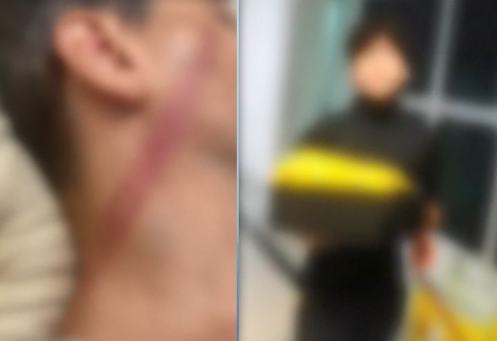 Policial militar é acusado de espancar metalúrgico com barra de ferro em São Paulo