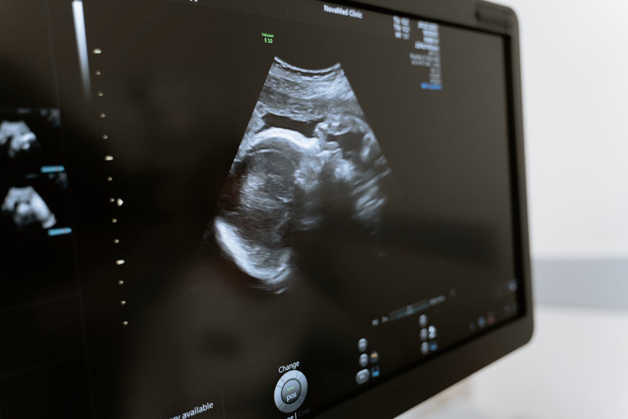 PL quer equiparar aborto a homicídio mesmo em caso de estupro, quando é permitido por lei. | Pexels