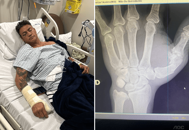 Popó vai passar por cirurgia. | Acervo pessoal