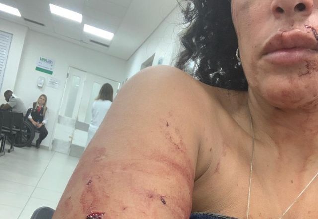 Mulher é agredida com garrafa em bar. Reprodução