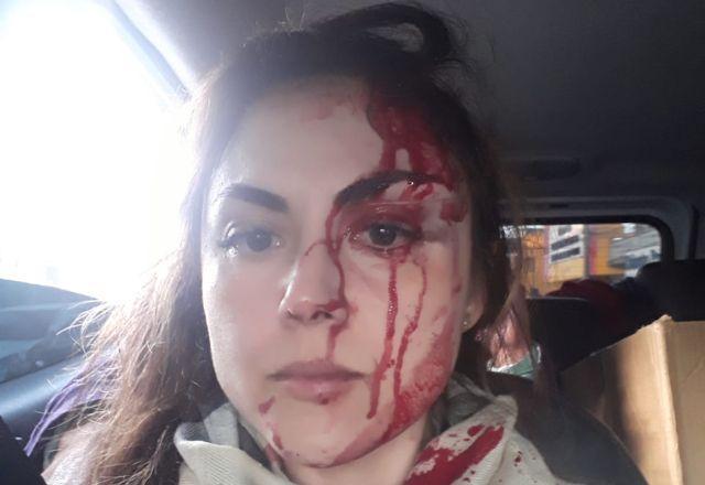 procuradora agredida por colega de trabalho