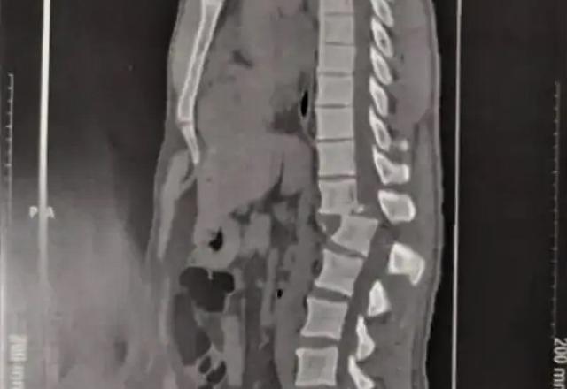 radiografia