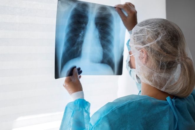 Médica olha uma radiografia do tórax | Reprodução/Freepik
